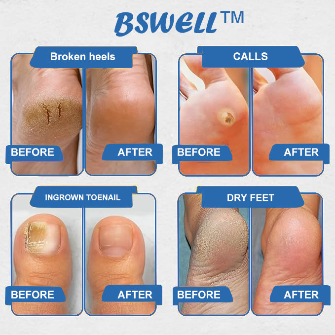 🦶🏻🔥80% OFF🏅BSWELL™ Propolis & Turmeric Foot Soak Beads