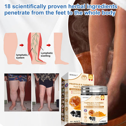 🦶🏻🔥80% OFF🏅BSWELL™ Propolis & Turmeric Foot Soak Beads